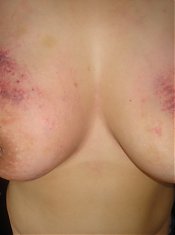 Plump Wives - Exclusive Amateur BBW pics
